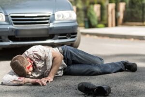 A car accident victim is lying on the street with a car visible in the background.